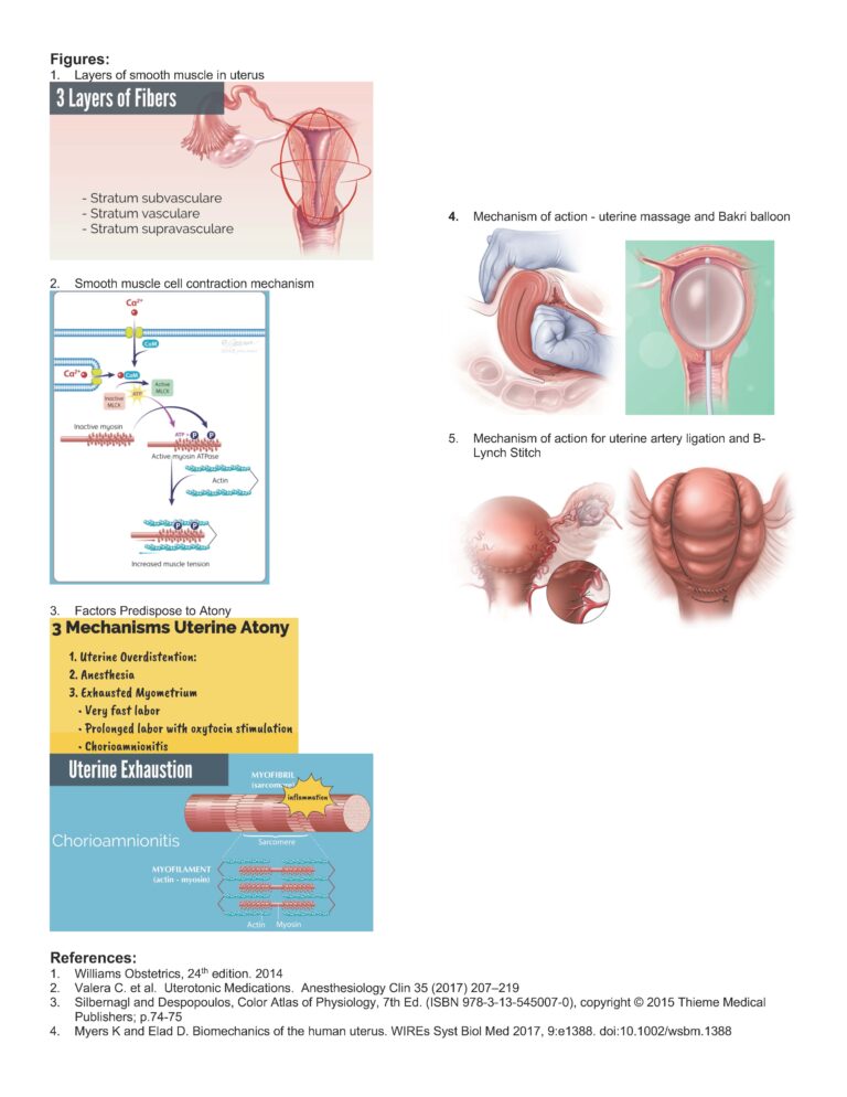 Uterine Atony – 21st Century Medical Education